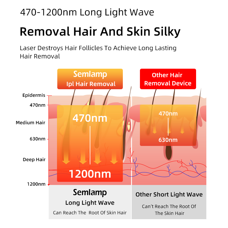 Semlamp IPL Hair Removal Device